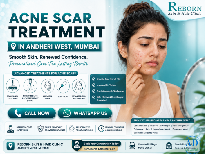 Acne scar treatment in Andheri West, Mumbai
