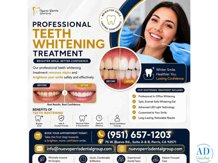 Teeth Whitening Treatment in Perris | Dr. Tejas Modi