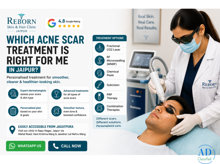 Acne Scar Treatment in Jaipur by Experienced Dermatologists