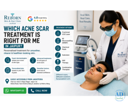 Acne Scar Treatment in Jaipur by Experienced Dermatologists