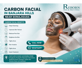 Advanced CO2 Laser Treatment in Banjara Hills, Hyderabad for Smoother & Healthier Skin