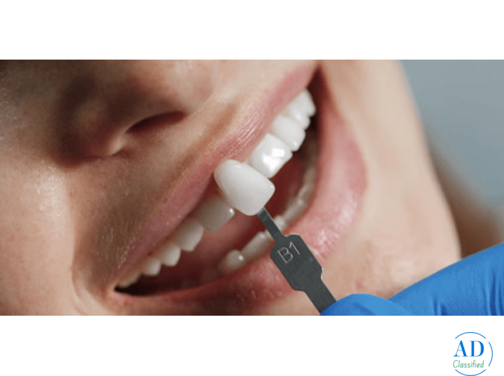 Dental Implant Clinic in Ludhiana with Advanced Technology