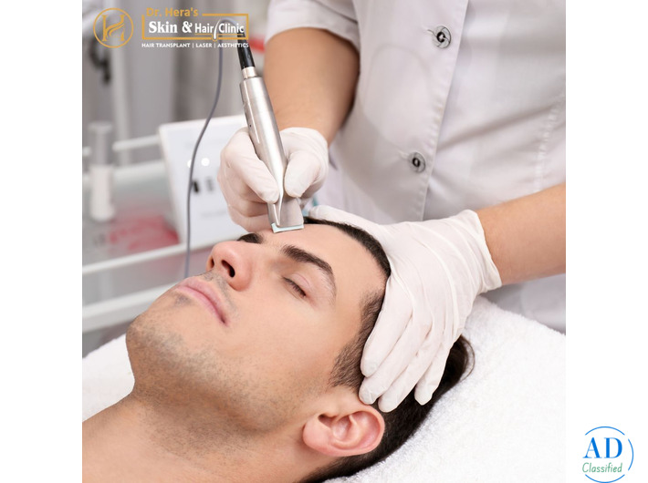 Advanced Hair Transplant In Roorkee For Natural Results