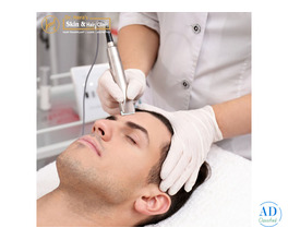 Advanced Hair Transplant In Roorkee For Natural Results