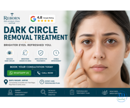 Best Skin Clinic for Dark Circle Treatment in Jaipur