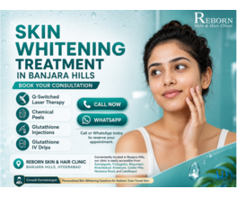 Advanced Skin Whitening Treatment in Banjara Hills, Hyderabad