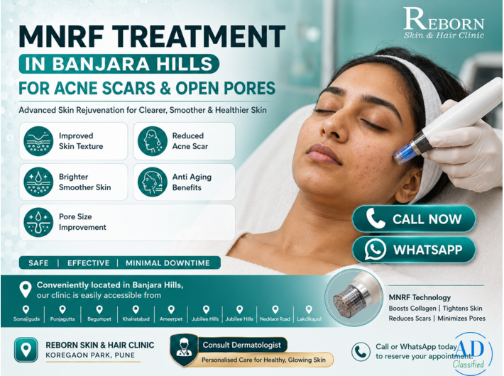 Expert MNRF Treatment near Jubilee Hills, Hyderabad for Acne Scars & Skin Rejuvenation