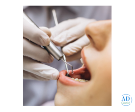 One Dentall - Oral & Maxillofacial Surgery