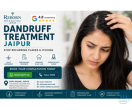 Dandruff Treatment in Jaipur for Monsoon Hair Concerns
