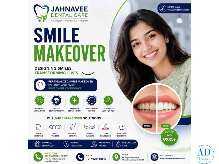 Smile Makeover Treatment in Ghatlodiya – DR. Jahanvee