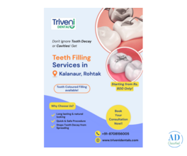 Tooth Filling Treatment in Kalanaur, Rohtak | Triveni Dental