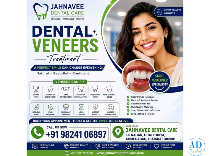 Dental Veneers Treatment in Ahmedabad - DR. Jahanvee