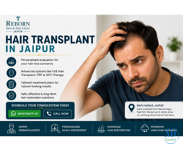Hair Transplant in Jaipur for Thinning Hair and Baldness