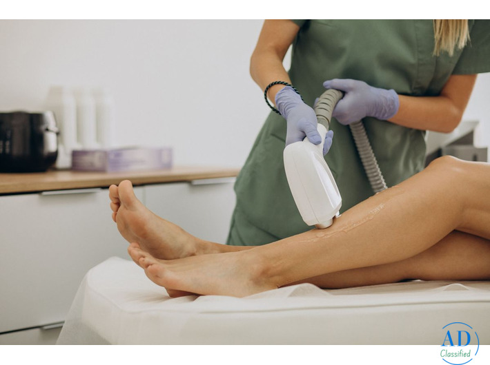 Laser Hair Reduction in Noida – Safe & Effective Treatment
