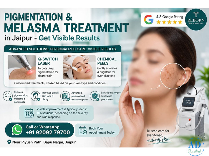 Dark Facial Patches? Consider Melasma Treatment Jaipur