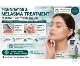 Dark Facial Patches? Consider Melasma Treatment Jaipur