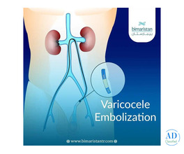 Best Varicocele Treatment: A Modern, Minimally Invasive Solution