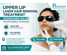 Advanced Upper Lip Laser Hair Removal Hyderabad