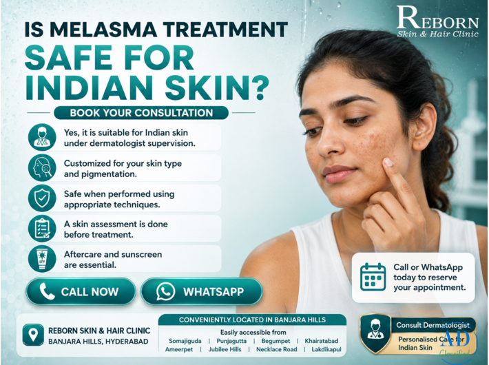 Effective Melasma Care for Healthy, Radiant Skin in Hyderabad