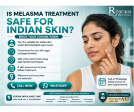 Effective Melasma Care for Healthy, Radiant Skin in Hyderabad