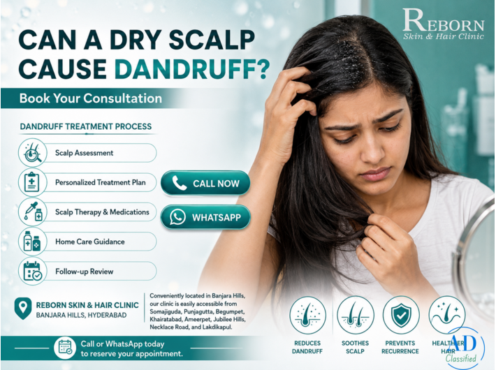Advanced Dandruff Treatment in Banjara Hills, Hyderabad