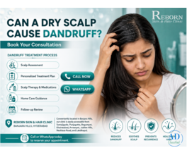 Advanced Dandruff Treatment in Banjara Hills, Hyderabad