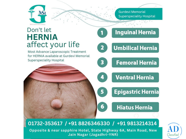 Hernia Operation in Yamunanagar | Trusted Hospital and Surgeons