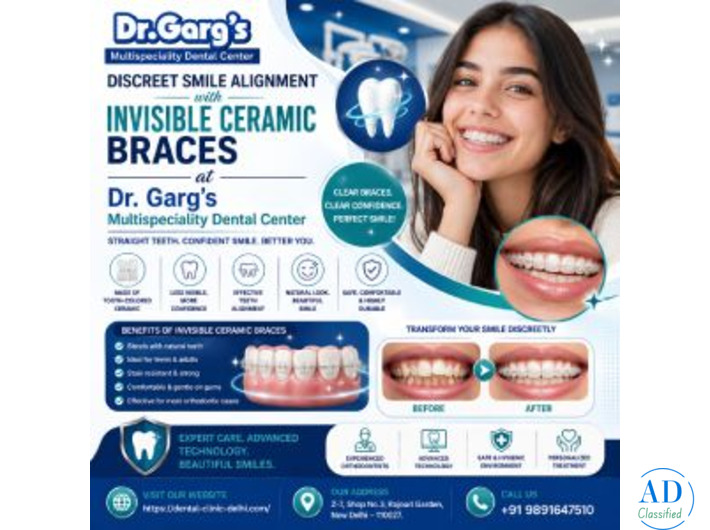 Discreet Smile Alignment with Invisible Ceramic Braces at Dr. Garg’s Multispeciality Dental Center