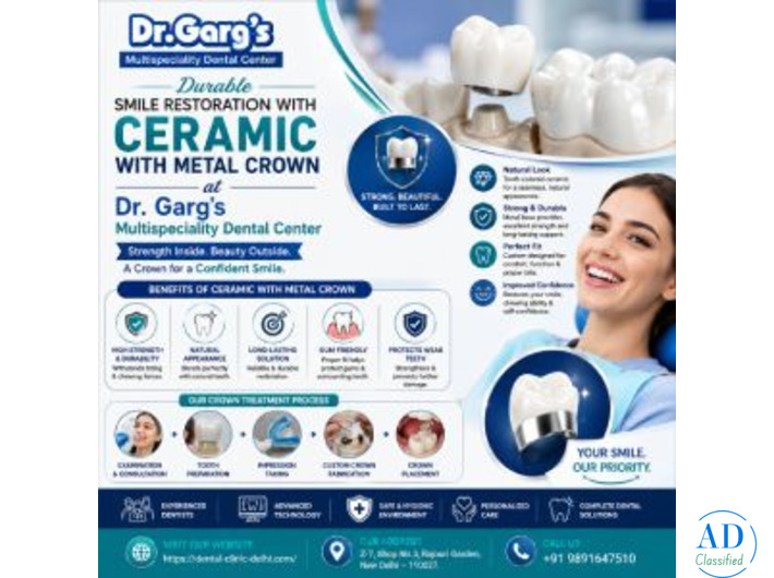 Durable Smile Restoration with Ceramic with Metal Crown at Dr. Garg’s Multispeciality Dental Center