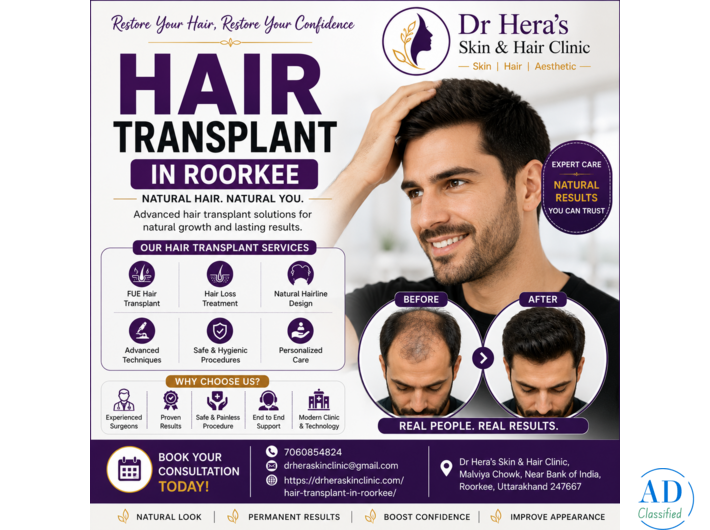 Affordable Hair Transplant In Roorkee With Expert Care