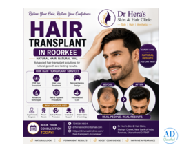 Affordable Hair Transplant In Roorkee With Expert Care