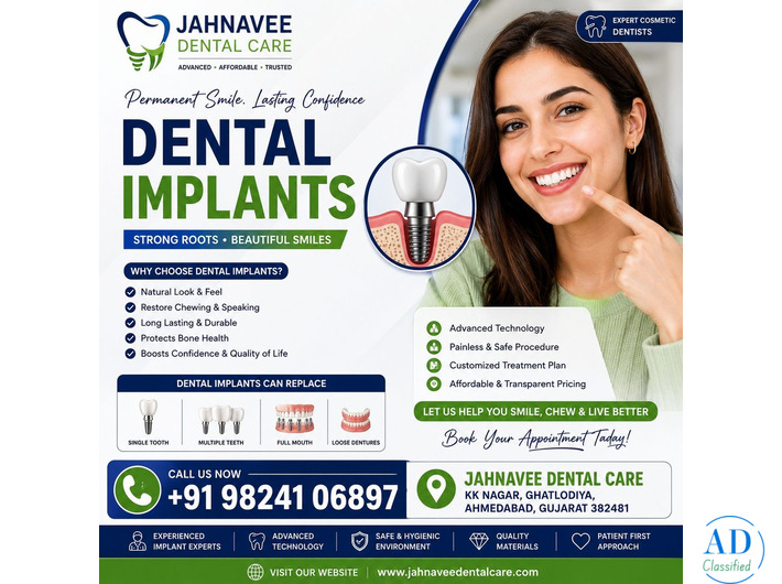 Get Dental Implants in Ahmadabad by Expert Dentists – Jahnavee