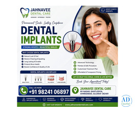 Get Dental Implants in Ahmadabad by Expert Dentists – Jahnavee