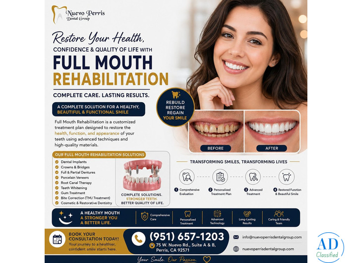 Full Mouth Rehabilitation treatment in Perris | Restore Smile