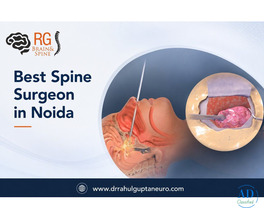 Understanding Spine Care and Treatment Options