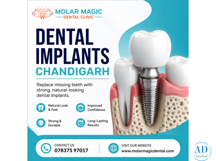Dental Implants in Chandigarh | Molar Magic Dental Clinic – Sector 33