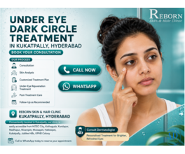 "Why Do I Have Dark Circles & What Are the Treatments?