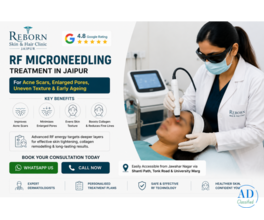 MNRF Treatment in Jaipur for Acne Marks