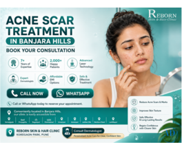 Acne Scar Reduction Treatment in Banjara Hills