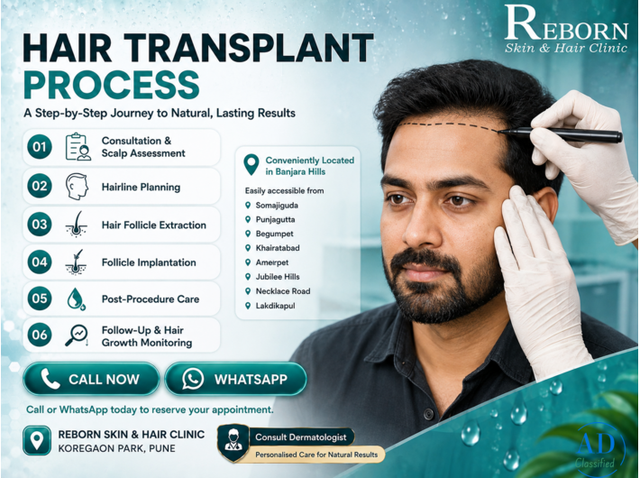 Hair Transplant in Banjara Hills: What Should You Know?