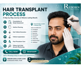 Hair Transplant in Banjara Hills: What Should You Know?