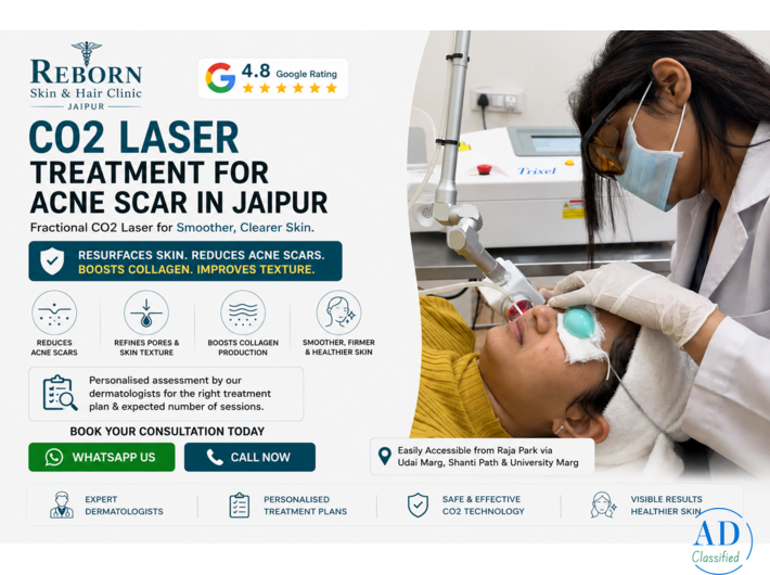 CO2 Laser Treatment for Acne Scars Available in Jaipur