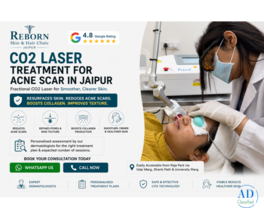 CO2 Laser Treatment for Acne Scars Available in Jaipur