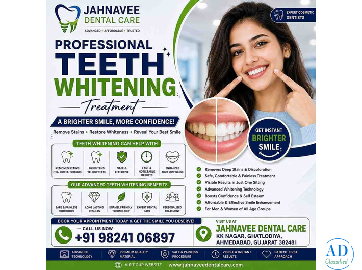 Teeth Whitening treatment in Ahmadabad | Brighten Your Smile