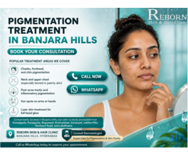 Does pigmentation affect men too?