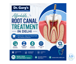 Affordable RCT Treatment Cost in Delhi | Dr. Garg’s Multispeciality Dental Center