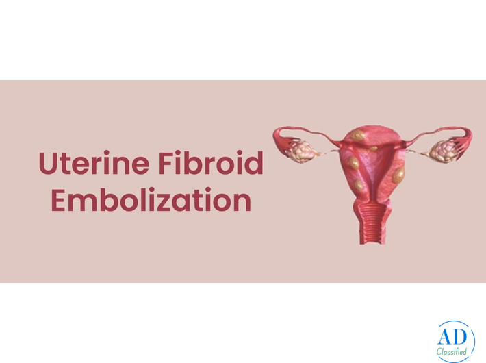 Uterine Fibroid Embolization Near Me | Minimally Invasive Treatment