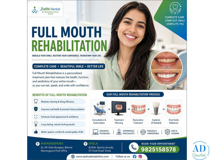 Full Mouth Rehabilitation in Ahmadabad | DR. Manish Shah