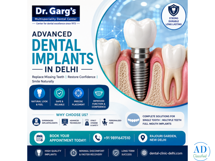 Advanced Dental Implants in Delhi | Dr. Garg’s Multispeciality Dental Center