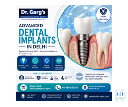 Advanced Dental Implants in Delhi | Dr. Garg’s Multispeciality Dental Center